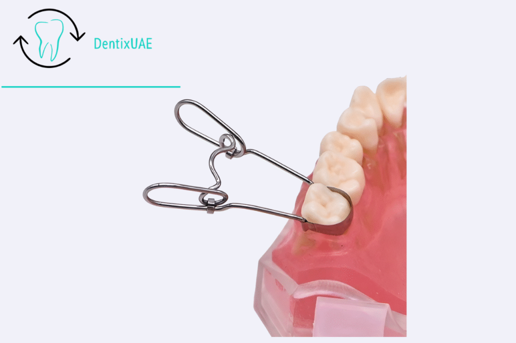 Saddle Matrix Kit – Complete Dental Restorative Tool Kit