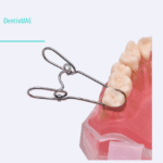 Saddle Matrix Kit ex1