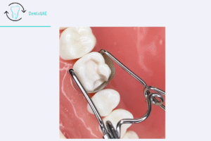 Saddle Matrix Kit ex2