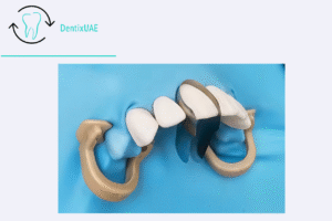 twin anterior matrix for Class III and IV