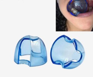 mouth opener, tongue and cheek retractor