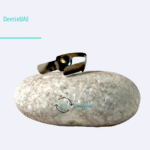 twin matrix for anterior composites