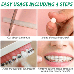 Braces wax