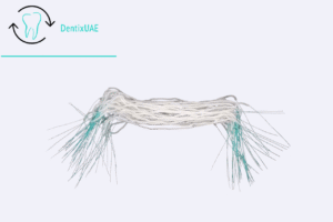 Superfloss-Special Dental Floss for Braces & Bridges